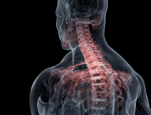 Neck Pain and the Deep Neck Flexors